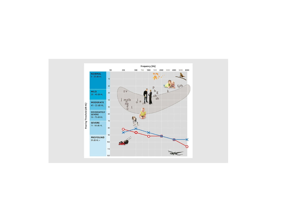 Degrees of Hearing Loss and Their Potential Impact in the Classroom